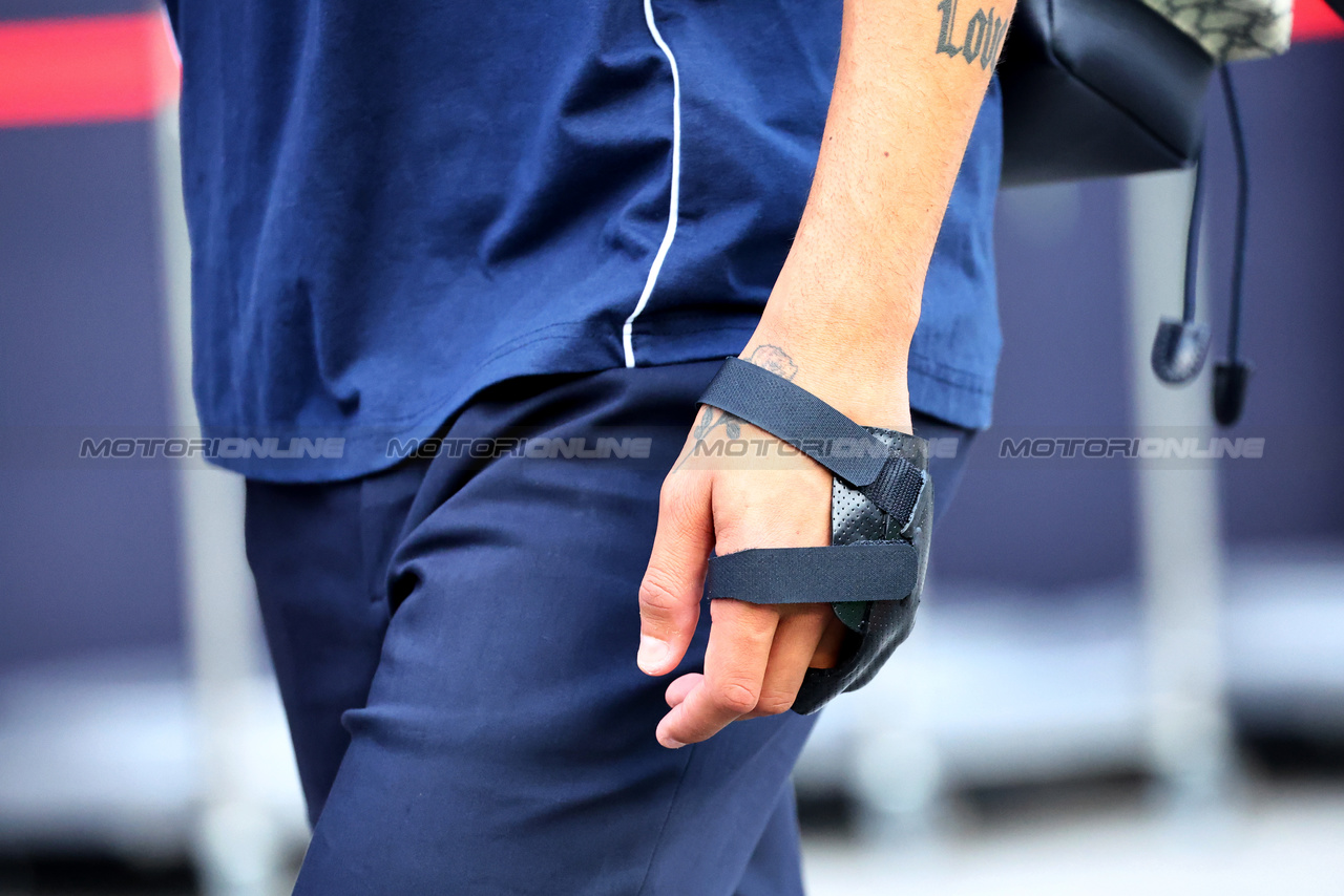 GP SINGAPORE, The injured hand of Daniel Ricciardo (AUS) AlphaTauri.

14.09.2023. Formula 1 World Championship, Rd 16, Singapore Grand Prix, Marina Bay Street Circuit, Singapore, Preparation Day.

- www.xpbimages.com, EMail: requests@xpbimages.com © Copyright: Batchelor / XPB Images